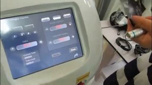 980 нм лазер для удаления сосудов