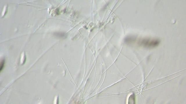 Простейшие.  Protozoa.