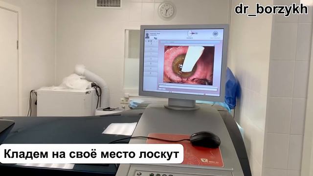 Лазерная коррекция зрения (SUPER LASIK) Виктор Борзых смотреть онлайн