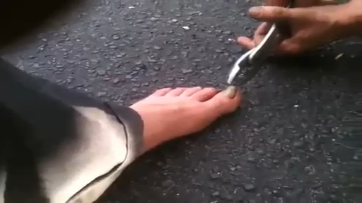 Gloups - Ongle incarné [Flokossama] смотреть онлайн