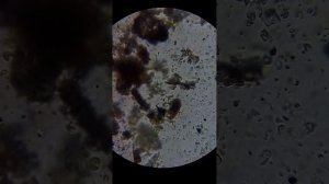 Смотрим на простейших в микроскоп. Научимся готовить препарат из мха.