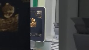 УЗИ 11 недель