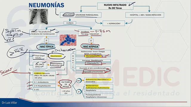 NEUMONÍA (MEDICINA INTERNA) смотреть онлайн
