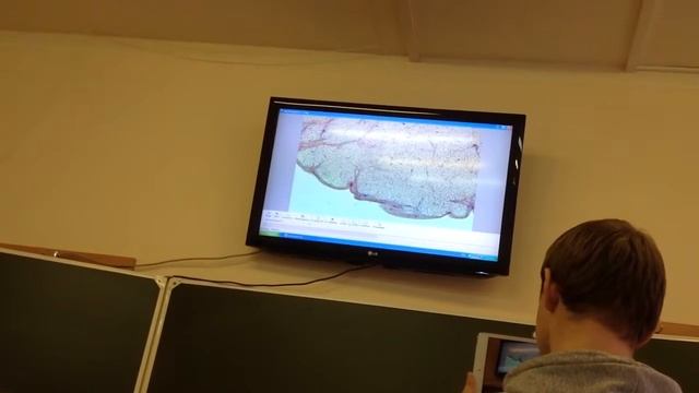 Гистология. Яичник Желтое тело свиньи (Женская половая) смотреть онлайн