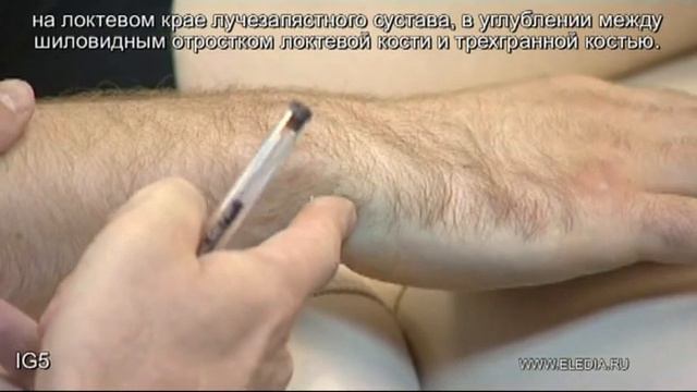 IG5 смотреть онлайн