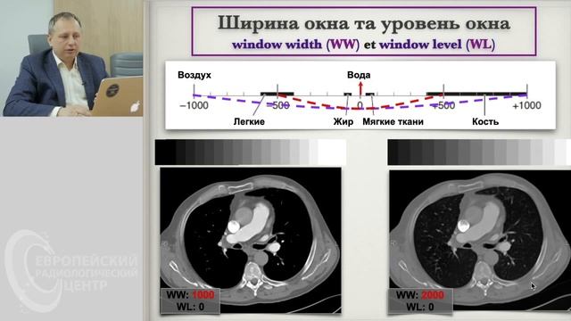 Часть 2. КТ - изображения. RAW-data (сырые данные),воксел и пиксел, шкала Хаунсфильда. Андрей Манго смотреть онлайн