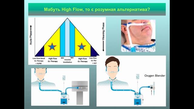 Коли інтубувати при тяжкій вірусній пневмонії і чи є альтернативи до інтубації. М.М. Пилипенко