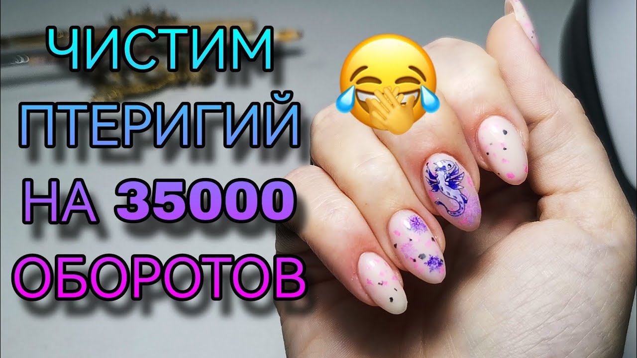 Чищу птеригий на 35000 оборотов Косячная работа. смотреть онлайн