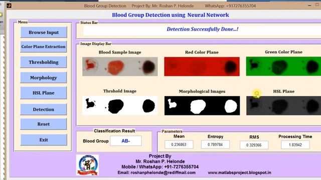 Matlab Code For Blood Group Type Detection Using Neural Network | Matlab Project With Source Code