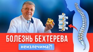 Болезнь Бехтерева НЕ ПРИГОВОР? Симптомы, лечение, профилактика, упражнения