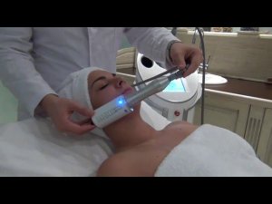 эндосфера лица