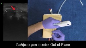 Техники визуализации иглы на УЗИ | IN and OUT of plane ULTRASOUND TECHNICS