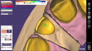 Exocad моделировка каркаса под 3D печать