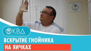 ✅ Вскрытие гнойника на яичках. Клинический случай №723