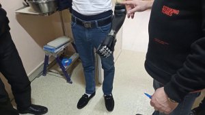 Протез плеча с внешним источником энергии.