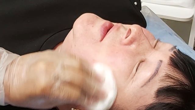 АирисКом студенты учатся: семинар для студентов. Коррекция периоральной области, морщины, заломы.