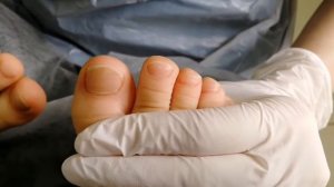 Детский педикюр