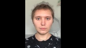 Таймлапс Роста Волос