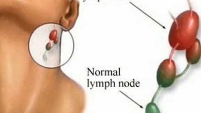 В ухе есть лимфоузлы. В ухе есть лимфоузлы. Тонзиллярные лимфоузлы. Лимфатические узлы на теле человека схема шейные. Тонзиллярные лимфоузлы.
