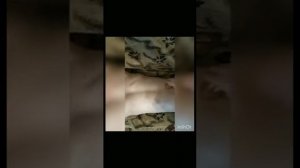 Массаж медицинскими банками