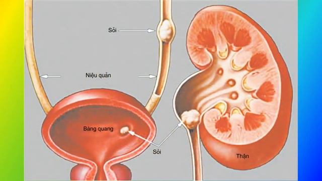 Phòng bệnh sỏi tiết niệu смотреть онлайн