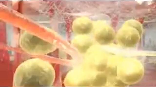 ELOS - помощник в борьбе с цилюлитом смотреть онлайн