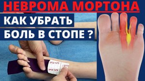 Боль в стопе_Неврома Мортона.mp4