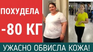 УЖАСНО ОБВИСЛА КОЖА ПОСЛЕ ПОХУДЕНИЯ | 6 МЕСЯЦЕВ | РЕЗЕКЦИЯ ЖЕЛУДКА | ОТЧЕТ