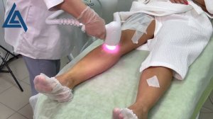 Обучение лазерной эпиляции на диодном аппарате. Зона голени
