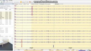 Как работать в программе  КОМПАКТ-НЕЙРО Электроэнцефалограмма -ЭЭГ