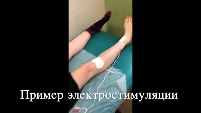 Электростимуляция мышц голени - SD 480p