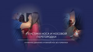 Риносептопластика до и после: неделя, две недели и два месяца после пластики носа