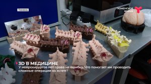 3D в медицине