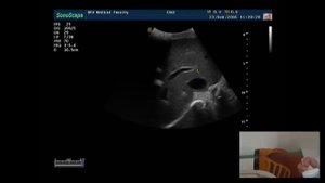 Практическое занятие: Работа с фантомом ABDfan  23091