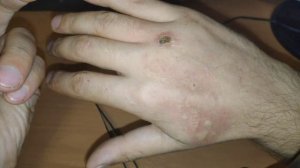 ? Жалит оса полиса / не повторять
