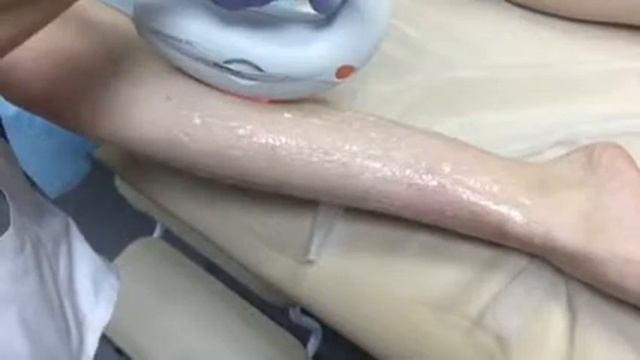 Фотоэпиляция Skinlux смотреть онлайн