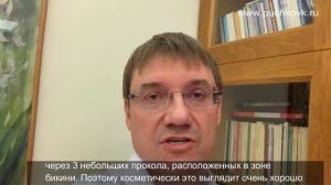Лапароскопическая коррекция диастаза прямх мышц брюшной стенки