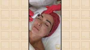 Подтяжка лица без нитей уникальным аппаратом BeauCo от Via Naama, моментальный эффект!