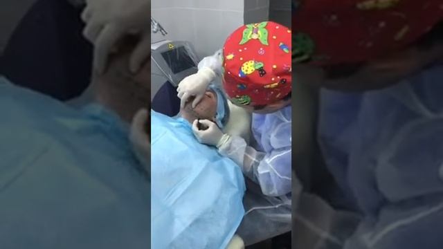 Постановка нитей аптос. Разметка