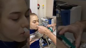 Вакуумное промывание пазух носа