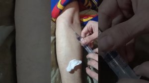научиться в поставили укол в Вена