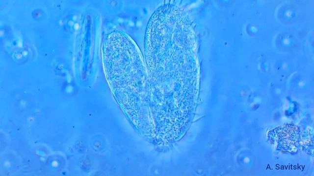 Конъюгация брюхоресничных инфузорий. \ Conjugation Hypotricha Ciliates.