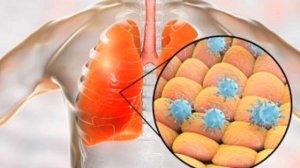 Эхинококкоз печени