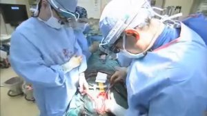 Кардиохирургия   Аорто коронарное шунтирование   Часть 3   Heart Bypass Surgery Explained Part3