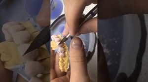 Нанесение керамики in-line 1й слой. МК. 8 передних зубов