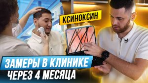 Замеряем эффективность ксиноксина для бороды? Результаты из лаборатории