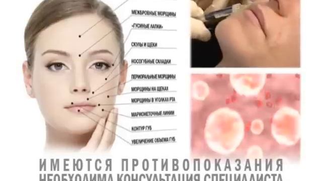 Контурная пластика. ЦКМ Кострома. смотреть онлайн