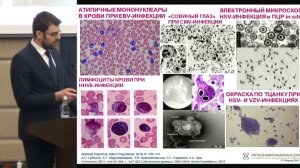 Викулов Г.Х. Респираторные и герпесвирусные инфекции. Алгоритм диагностики и лечения