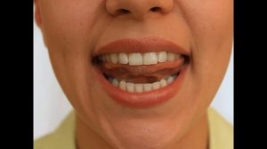 Артикуляционная гимнастика - Комарик