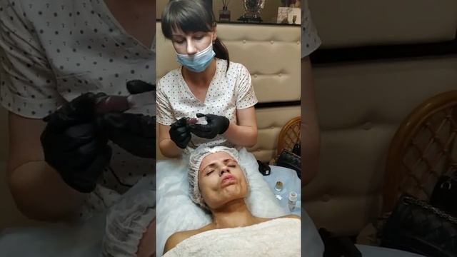 Фракционная мезотерапия ( МИКРОНИДЛИНГ)
